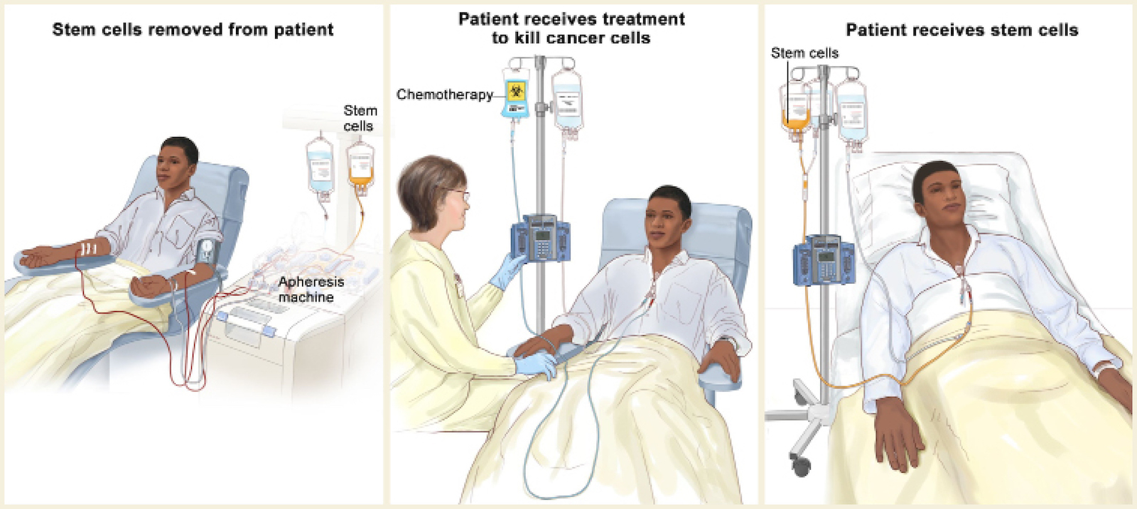 Illustration of the patient's treatment process